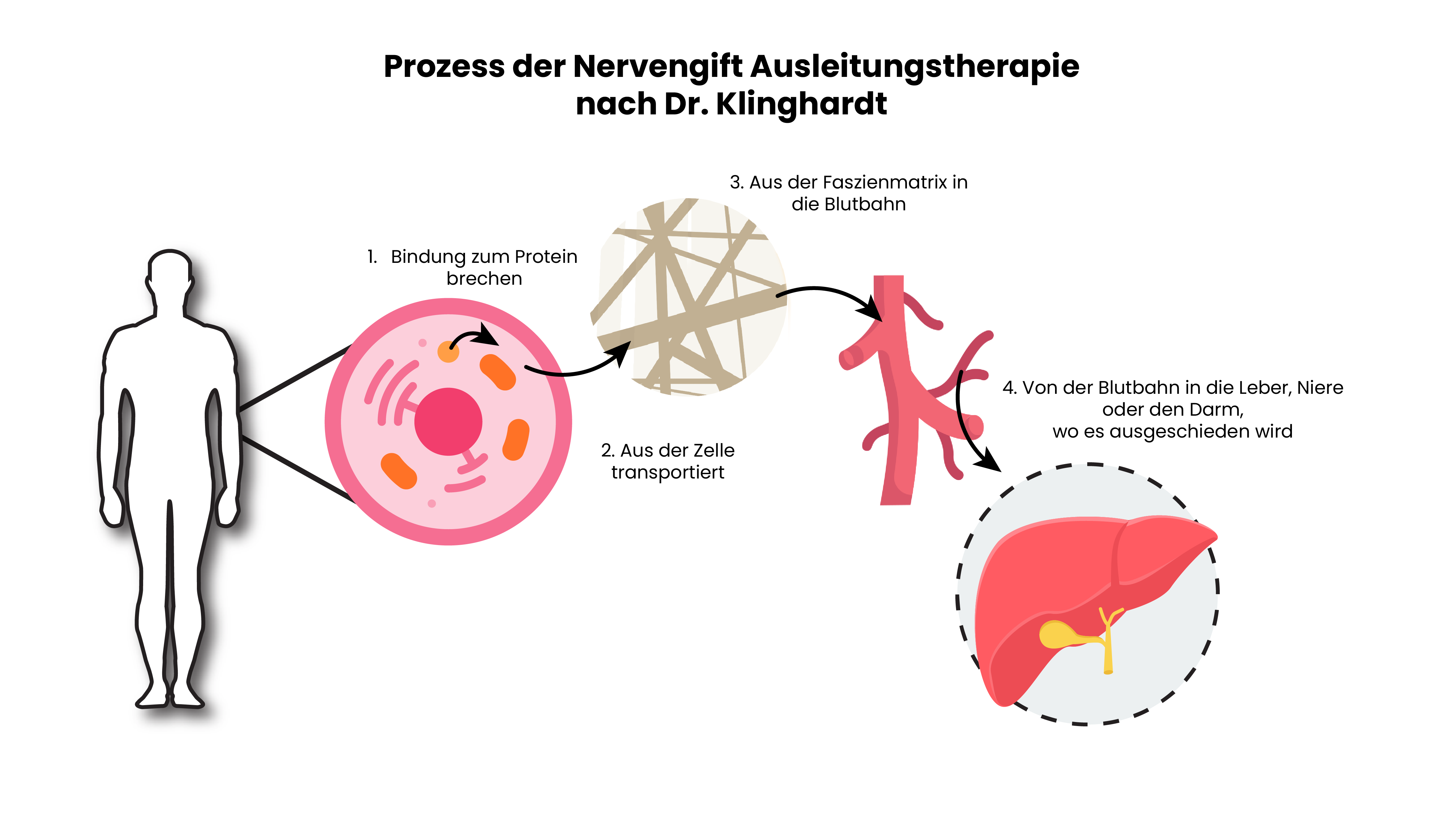 Metallausleitung nach der Klinghardt Methode. So leitest du Metalle aus deinem Körper. Entgiftungsanleitung.